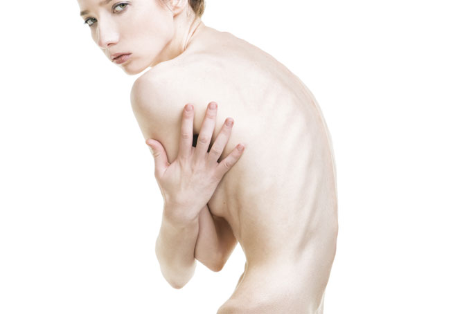 L'Anoressia, Cosa è e Come Uscirne